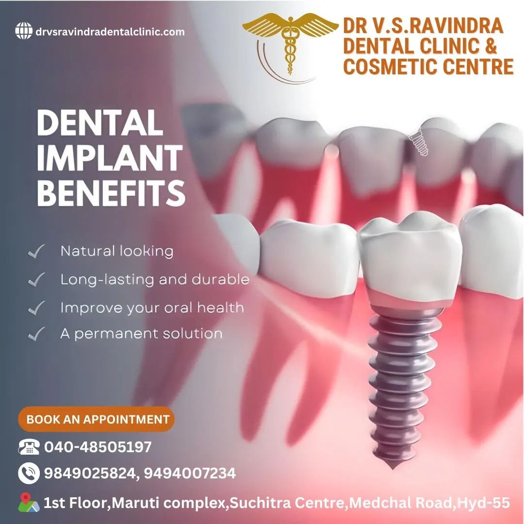 Read more about the article Best Dental Implant Clinics