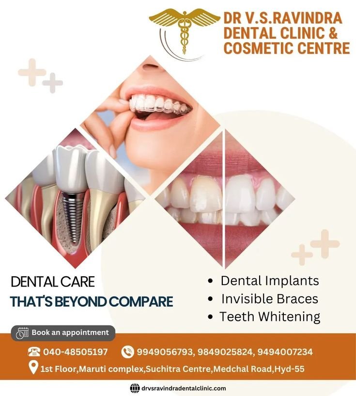 Read more about the article Best Dental Hospitals in Suchitra-Cross-Road Hyderabad