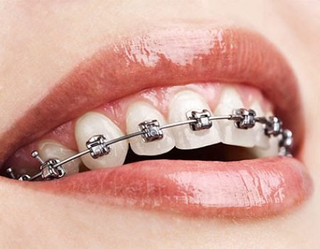 Orthodontics